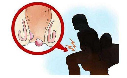 广州东大医院：痔疮通过这些不良的饮食习惯找上你了！