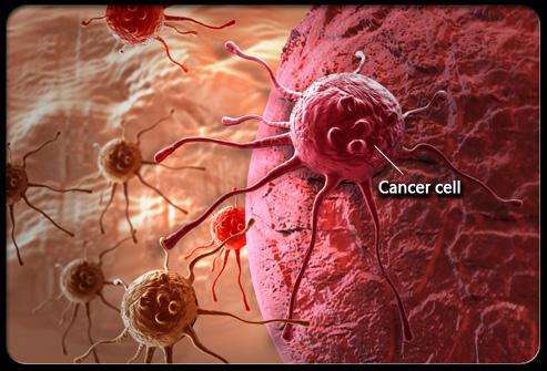 什么是直肠癌骨转移 转移了怎么办?广州东大医院骗人吗